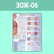 Плакат «Венерические заболевания» (ЗОЖ-06, ламинир. бумага, A1, 1 лист)